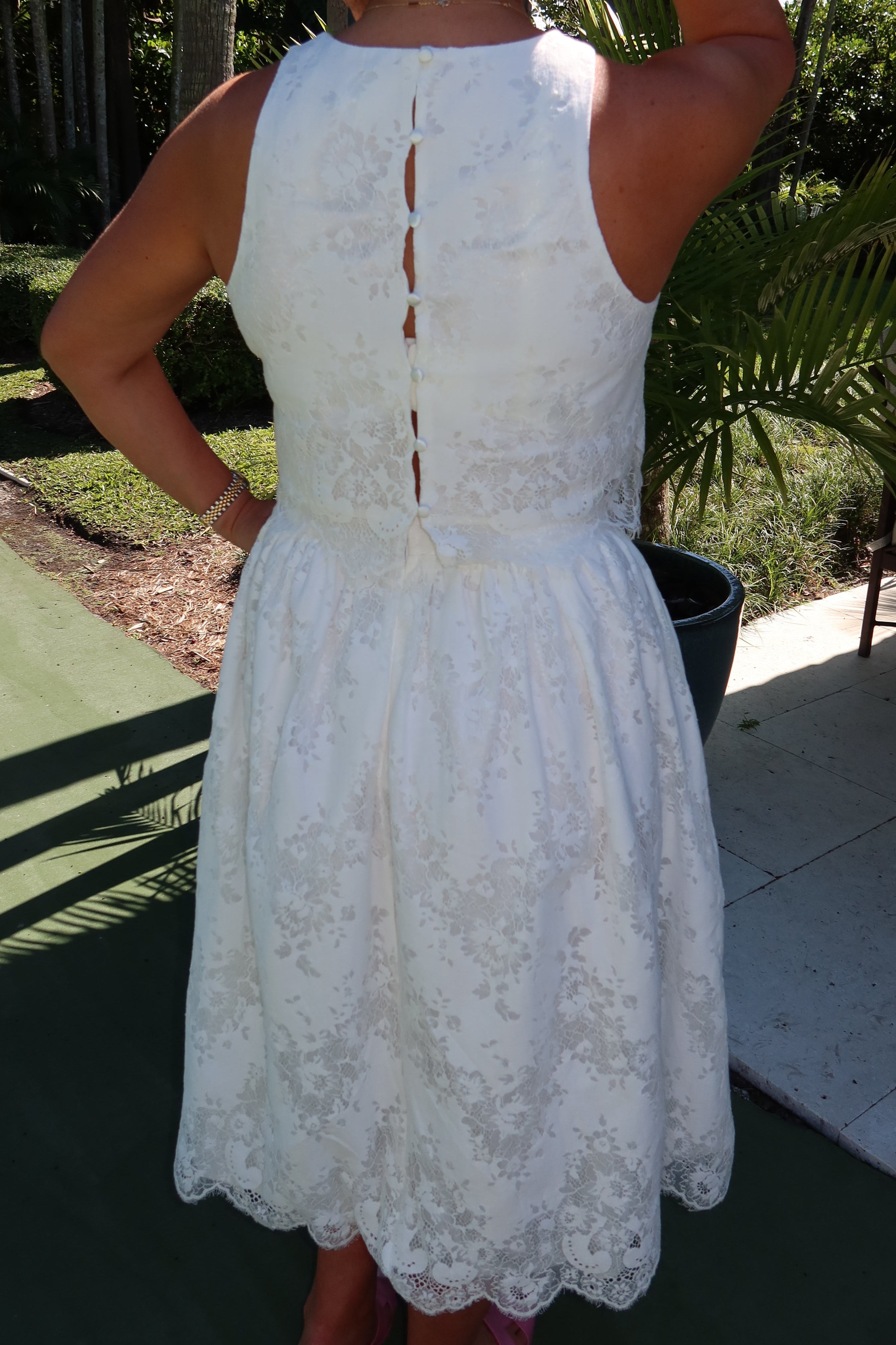 The Anna Lace Set